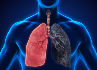 Current Smokers, People With COPD At High COVID-19 Risk
